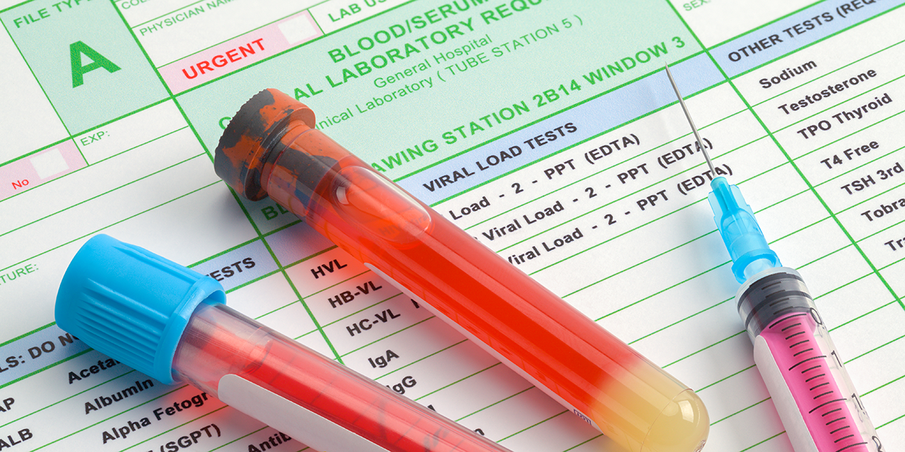 Two vials of blook and a syringe laid on top of blood testing paperwork.